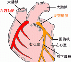 心臓に血液を運ぶのが冠動脈です。