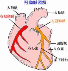 心臓に血液を運ぶのが冠動脈です。
