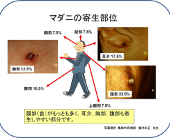 マダニ寄生部位