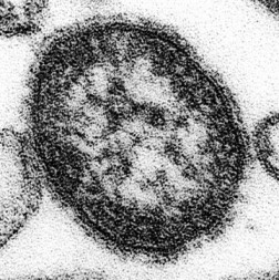 麻疹（はしか）ウイルス