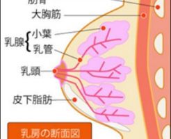乳癌 乳房内側面図