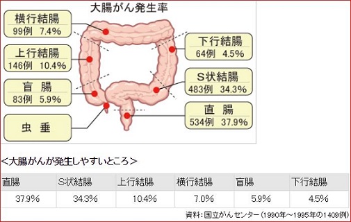 大腸がん発生率